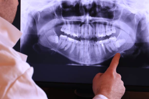Best Emergency TMJ Treatment in Brookston, IN